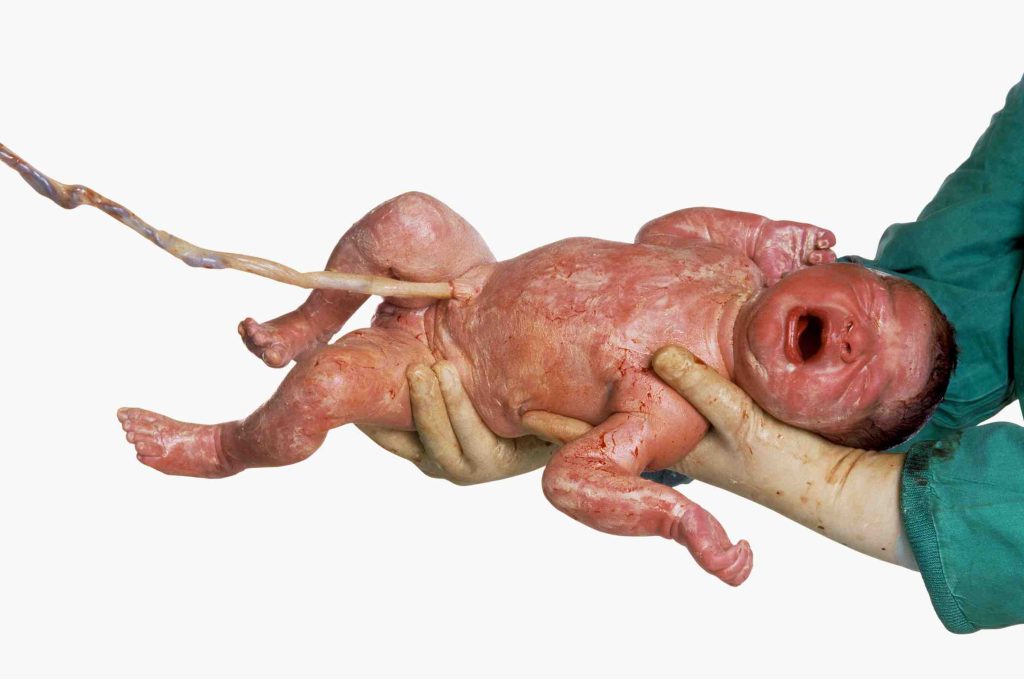 Oliviero Toscani, Cuori, United Colors of Benetton, 1996 (© Oliviero Toscani)