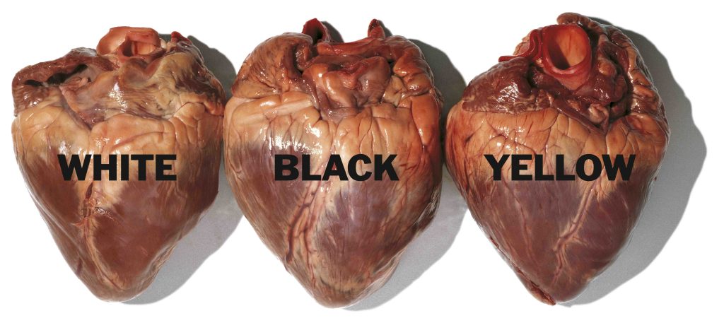 Oliviero Toscani, Cuori, United Colors of Benetton, 1996 (© Oliviero Toscani)