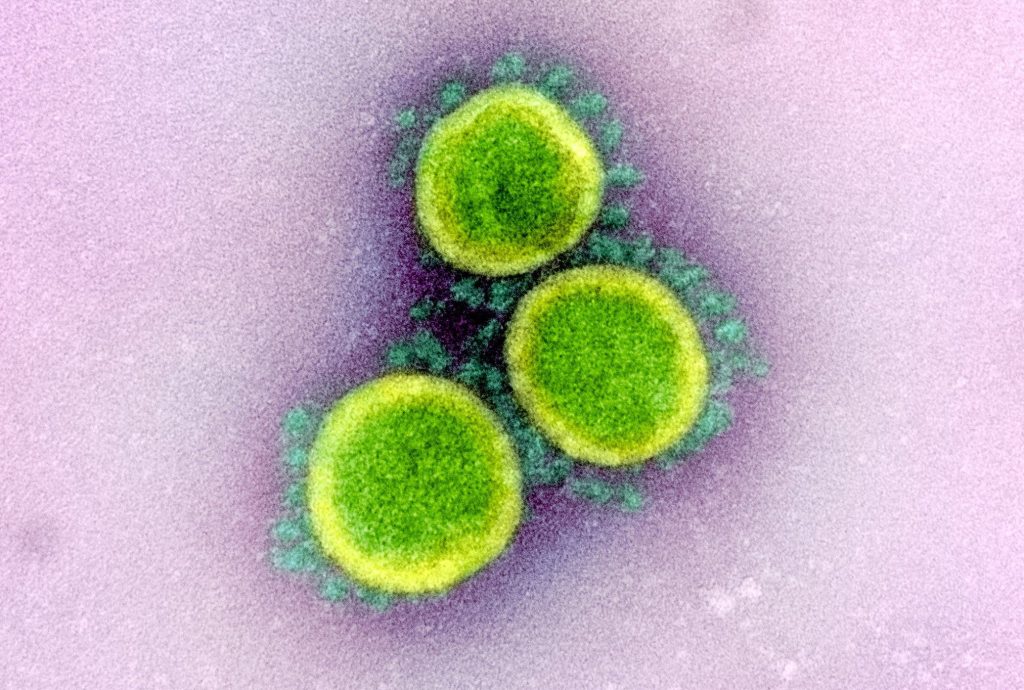Ecco come appare il nuovo Coronavirus (Keystone)